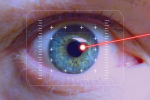 Αθλητισμός και επεμβάσεις laser στα μάτια