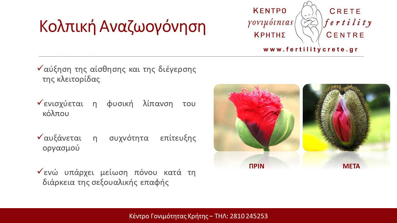 Crete-Fertility-Centre-Kolpikh-anazwogonhsh Crete Fertility Centre Kolpikh anazwogonhsh