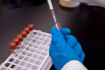 Αποτυχία για πειραματικό εμβόλιο κατά του HIV