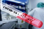 Λοίμωξη Covid-19 – Κριτήρια για εργαστηριακό έλεγχο