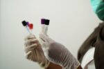 Θετικά τα στοιχεία για τη θεραπεία μονοκλωνικών αντισωμάτων