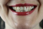 Πώς η πανδημία επηρεάζει τα… δόντια μας